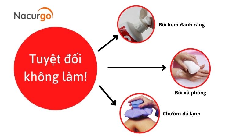 Không bôi “thuốc dân gian” trị bỏng bô! 1