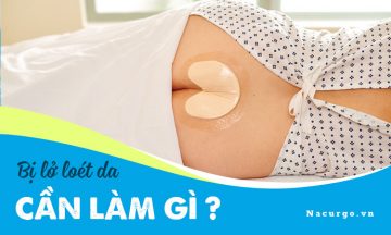 Giải đáp thắc mắc: Bị lở loét da cần làm gì? Giải đáp thắc mắc: Bị lở loét da cần làm gì?