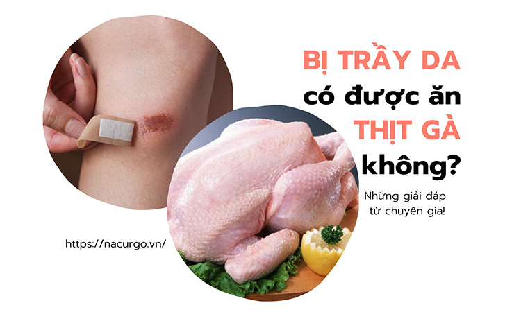 Khâu có được ăn thịt gà không? Hướng dẫn dinh dưỡng sau phẫu thuật