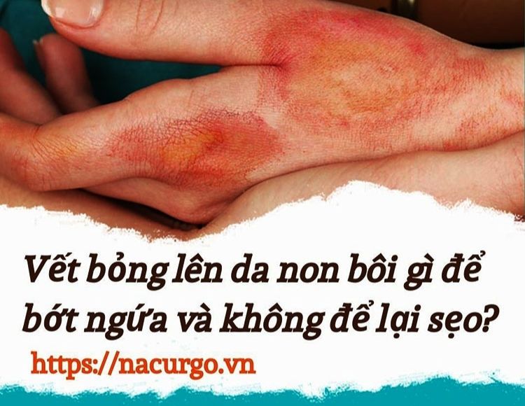  Làm thế nào để giảm ngứa và đau khi lên da non bị ngứa?
