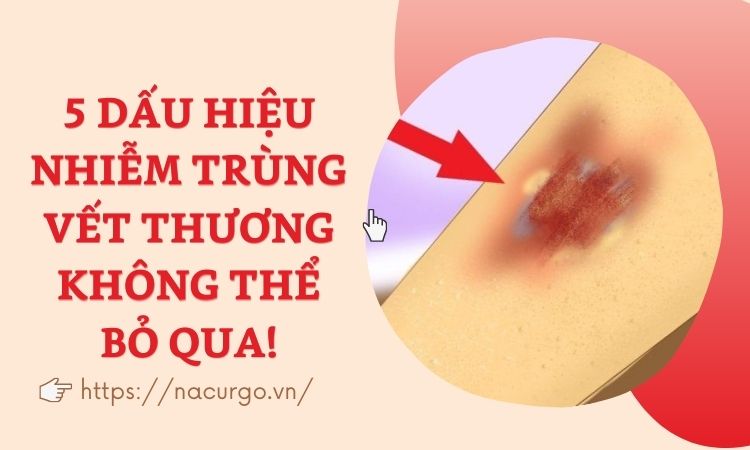 5 dấu hiệu bị nhiễm trùng vết thương không thể bỏ qua!