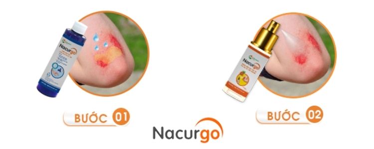 Hướng dẫn sử dụng Bộ sản phẩm chăm sóc vết thương Nacurgo 1