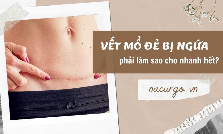 Thật sự ngứa vết mổ sau sinh có thể làm tắc nghẽn quá trình phục hồi hay không?
