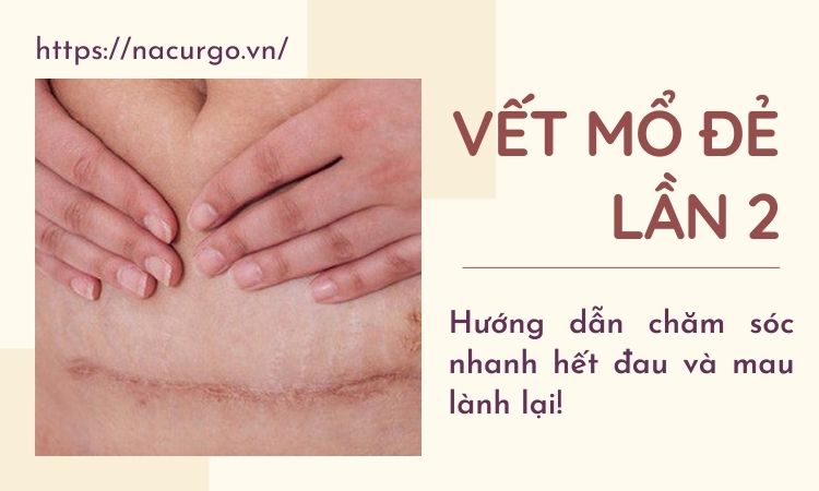 Vết mổ đẻ lần 2 bao lâu thì hết đau, lành? Chăm sóc thế nào?