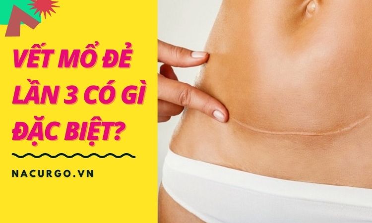 Vết mổ đẻ lần 3 có gì đặc biệt? Chăm sóc sao cho đúng?