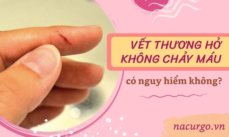 Có phương pháp nào để xử lý vết xước da không chảy máu tại nhà?
