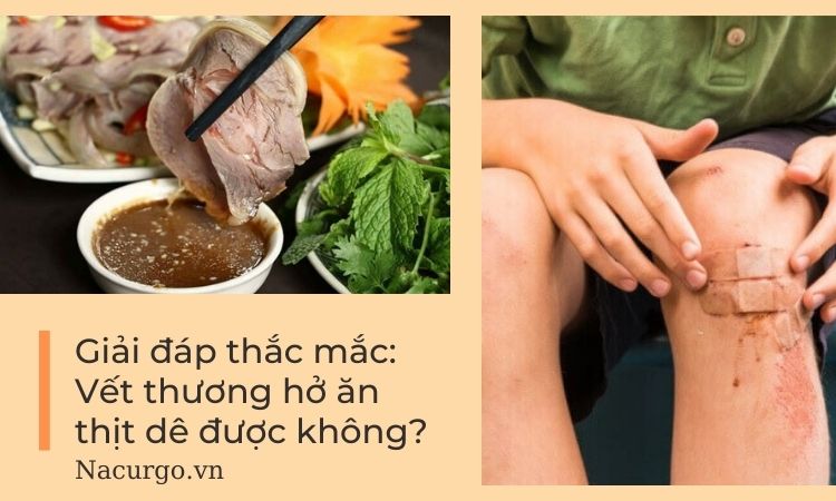 Vết Thương Hở Ăn Thịt Dê Được Không? Lợi Ích Và Tác Hại Cần Biết