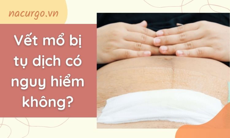 Tụ dịch vết mổ sau sinh có ảnh hưởng đến khả năng mang thai lần sau?
