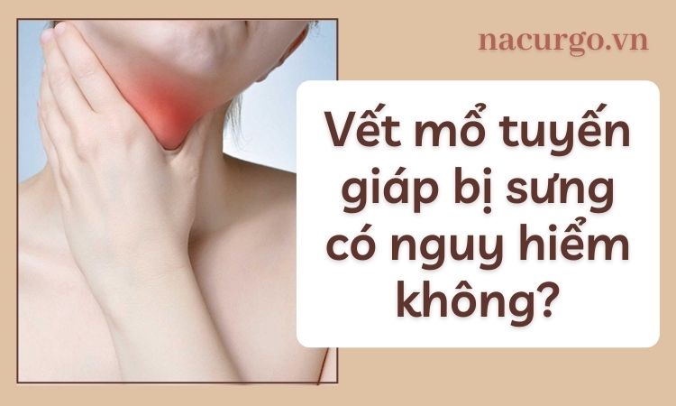 4. Khi nào cần đến bác sĩ khi vết mổ tuyến giáp bị sưng?