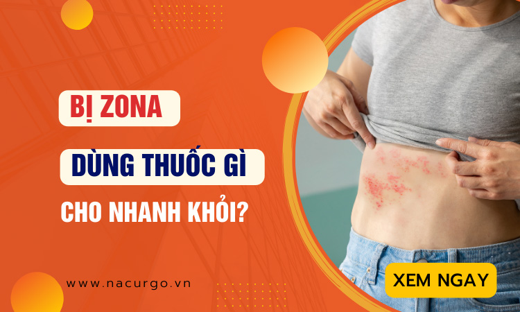 Bị zona thần kinh bôi thuốc gì cho nhanh khỏi