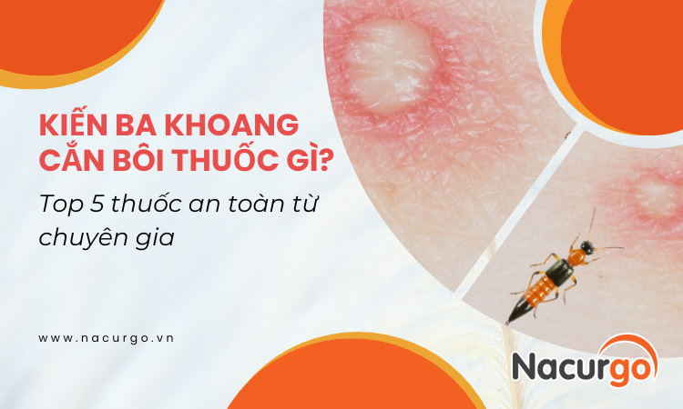 Kiến ba khoang cắn bôi thuốc gì