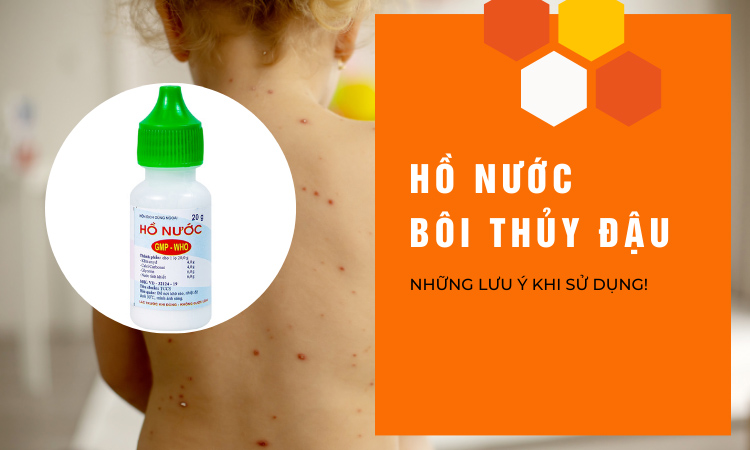 Hồ nước bôi thủy đậu được không? 